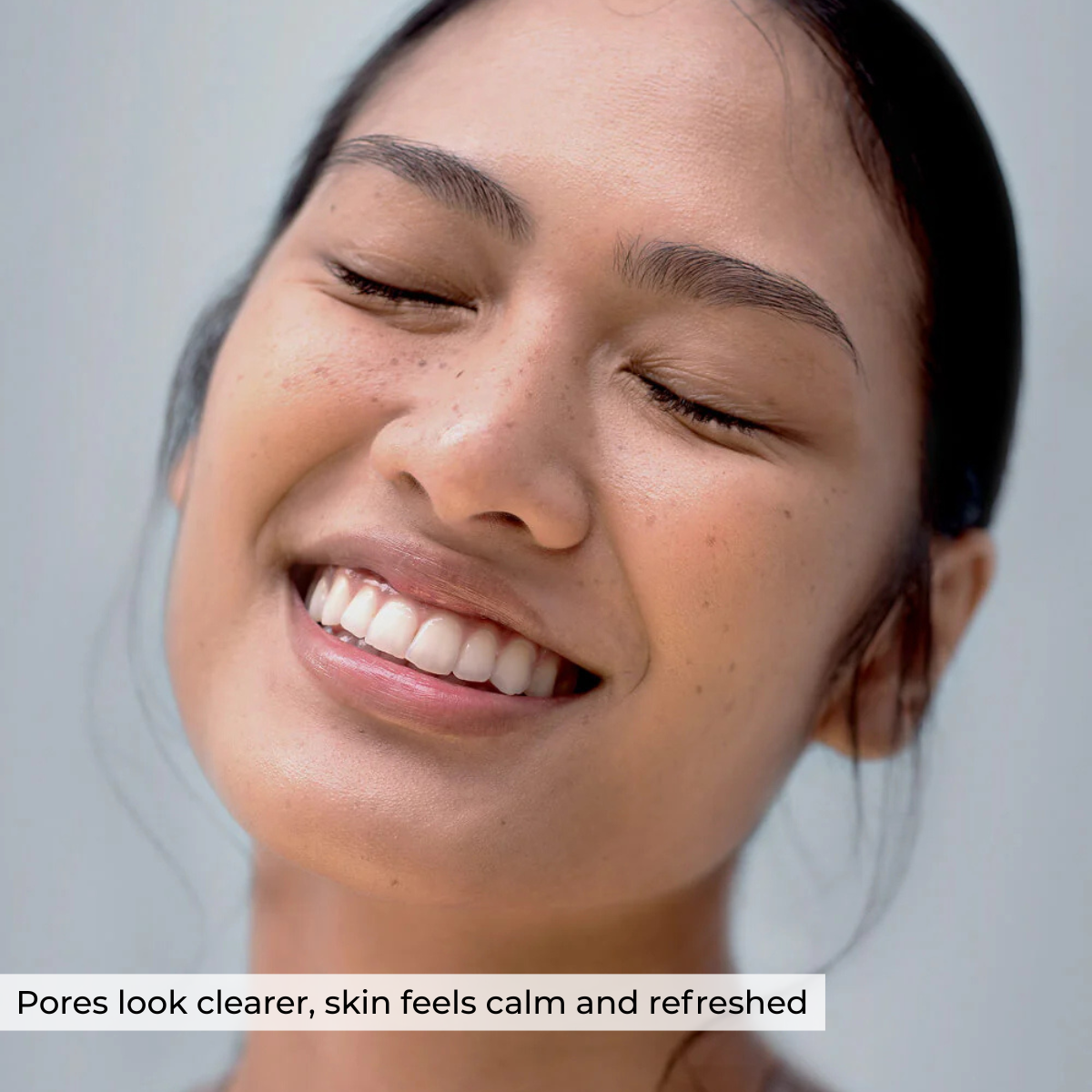 Hydrocolloid Nose Patch
